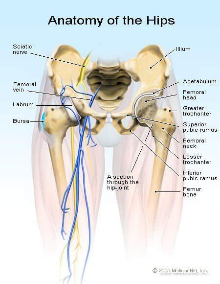 Medical Definition Of Broken Hip