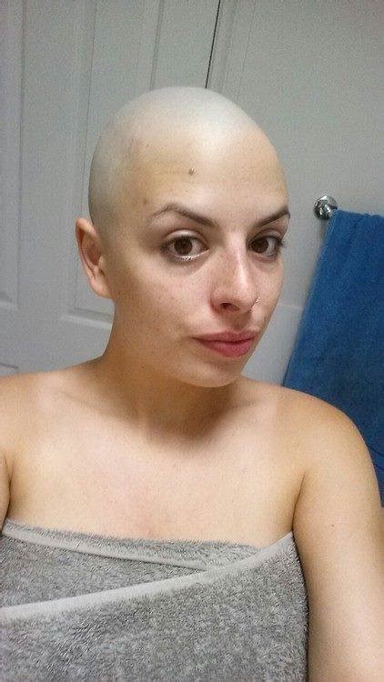 Bald Shaved Ladies Pics And Galleries