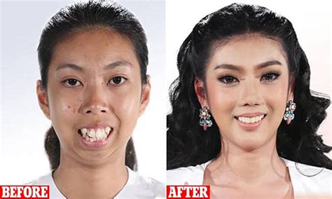 plastic surgery results shown      daily mail
