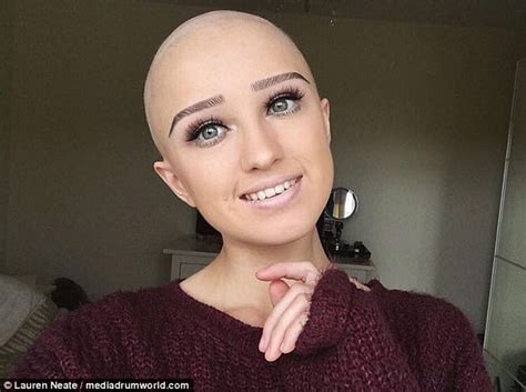Bridgend Girl With Alopecia Posts Selfies Of Her Bald Head Daily Mail