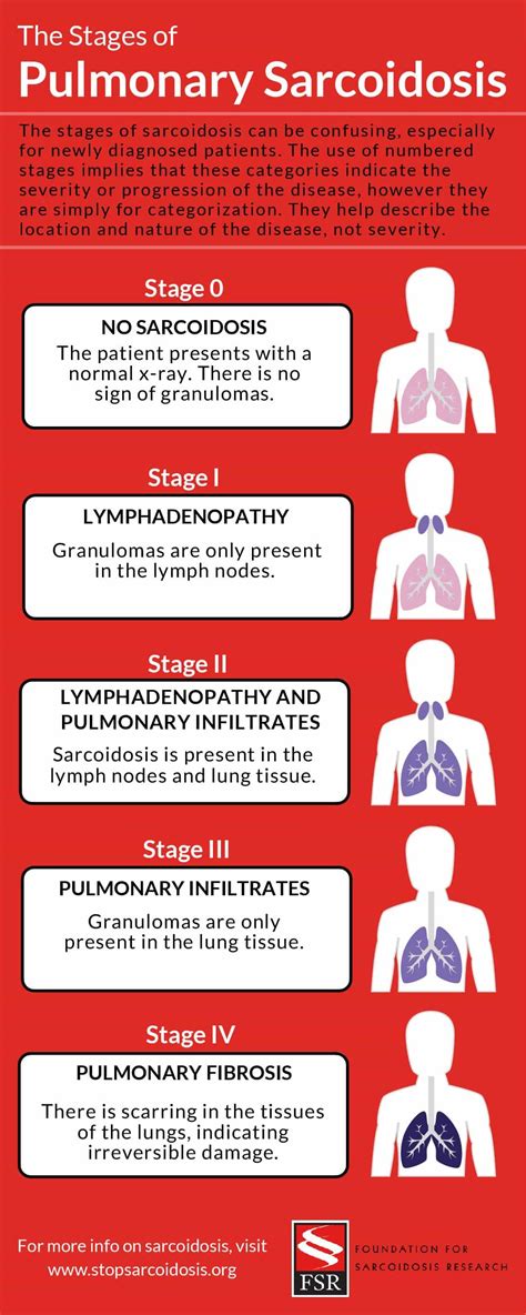 Understanding The Stages Of Pulmonary Sarcoidosis Foundation For