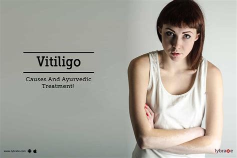 Vitiligo Causes And Ayurvedic Treatment By Dr Jyotsna Makkar