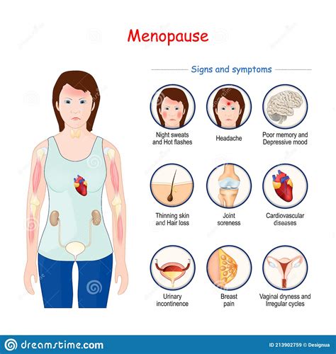 Menopause Climacteric Signs And Symptoms Stock Vector Illustration