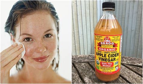 top 10 health benefits of apple cider vinegar with the mother 8 is