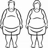 Obesity Obese Clipart People Morbidly sketch template