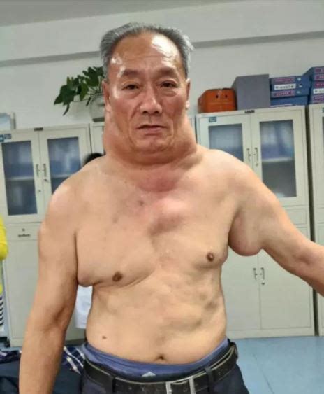 Meet The Man Who Now Looks Like The Hulk After 30 Years