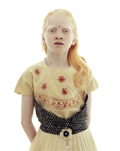 somali albino somalinet forums