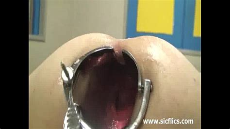 shocking anal speculum gaping and fisting xvideos