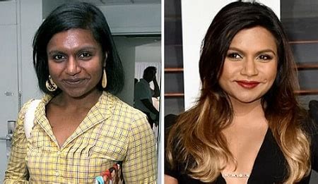 mindy kaling plastic surgery rumors compare    pictures