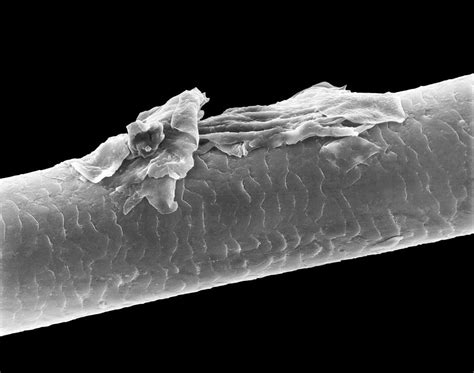 human hair  dandruff photograph  dennis kunkel microscopyscience photo library pixels
