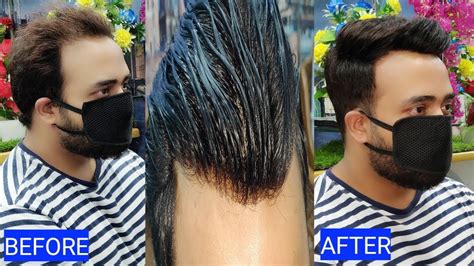 front  natural hair  hair patch system  anas sheikh call    info