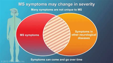 multiple sclerosis signs symptoms  treatments multiple