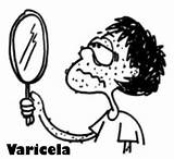 Varicela sketch template