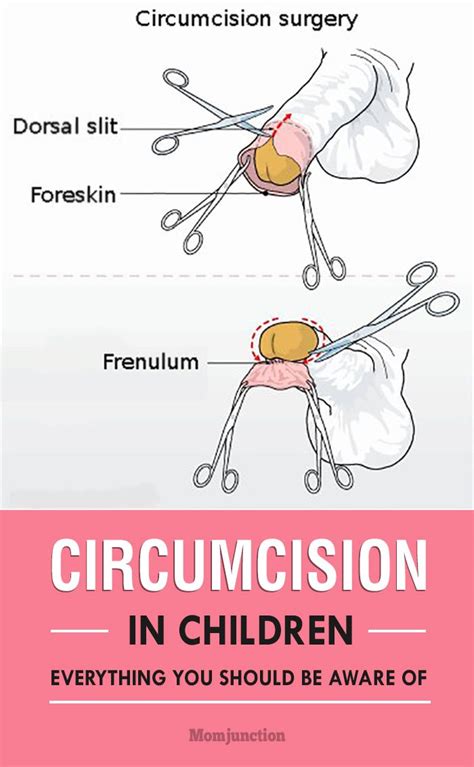 87 best circumcision images on pinterest human rights