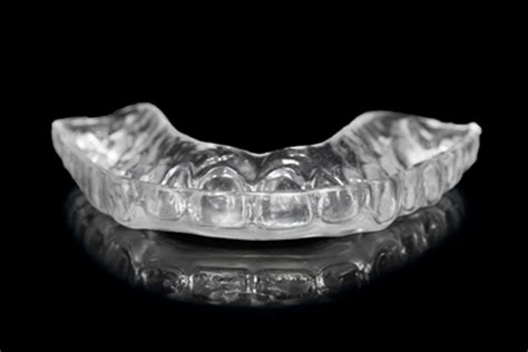 porcelain veneers  mississauga tooth veneers britannia dental care