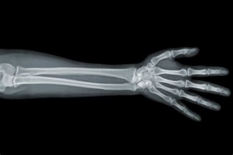 Snooping On The X Ray Tech A Patient’s Dilemma — Propublica