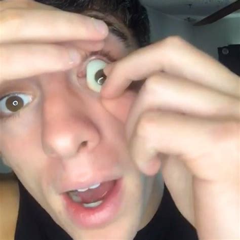 ladbible lad shares what it s like having a prosthetic eye