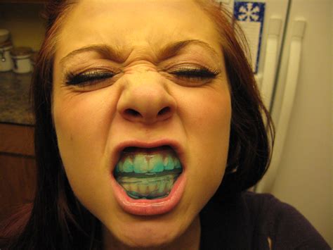 myrtle ferguson blue teeth