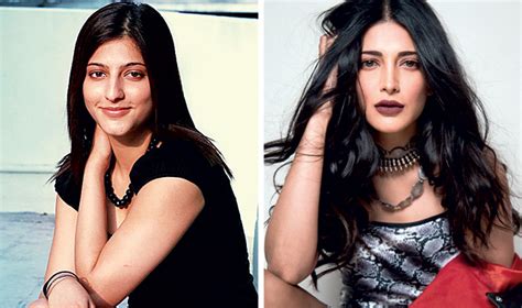 Shruti Haasan There Was A Time I Went Crazy With Lip Fillers