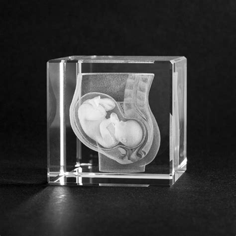 modell der schwangerschaft unterleib mit baby  glas