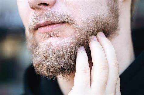 beard transplantation worthy   men hit  genetic jackpot  evolved hair