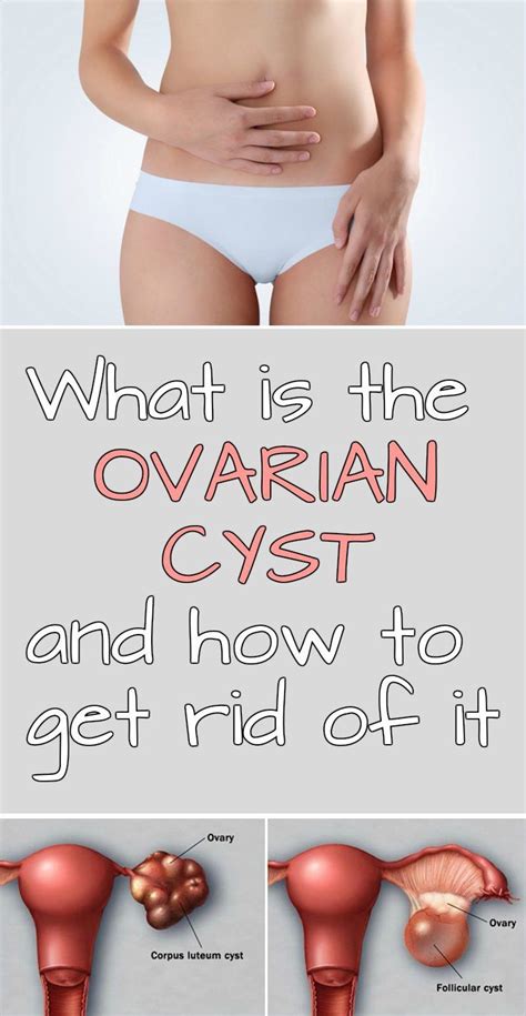 what is the ovarian cyst and how to get rid of it ovarian cyst