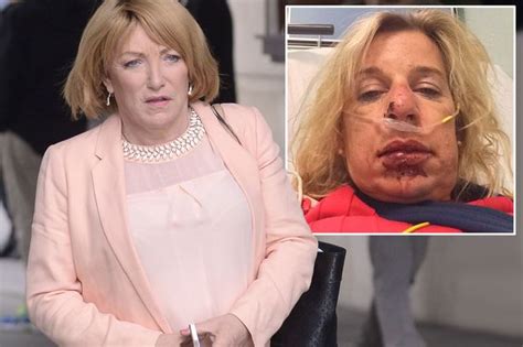Kellie Maloney Gets Her Own Back On Katie Hopkins By