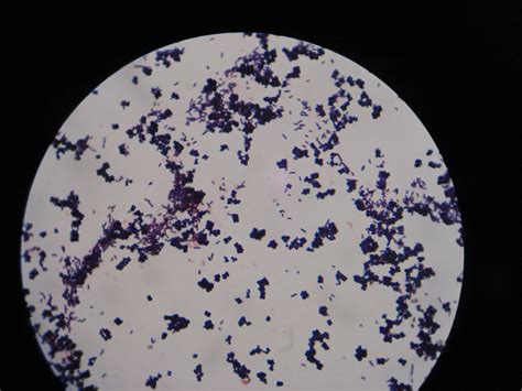 Dvc Microbiology 146 Fall 11 Gard Lab 1 Gram Stained