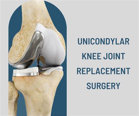 unicondylar knee joint replacement surgery knee shoulder surgeon