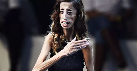 lizzie velasquez woman labelled ugliest in the world by online
