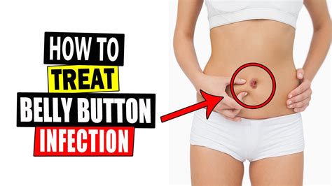 How To Treat Belly Button Infection At Home Home Remedies For Belly