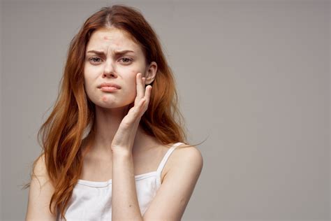 facials   hormonal acne xenana spa portland oregon