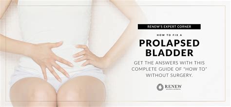how to fix a prolapsed bladder without surgery a complete guide