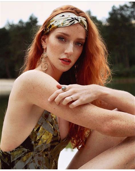 Pin By Island Master On Beautiful Freckles Gingers In 2020