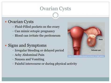 ppt gynecology powerpoint presentation free download id 2029956