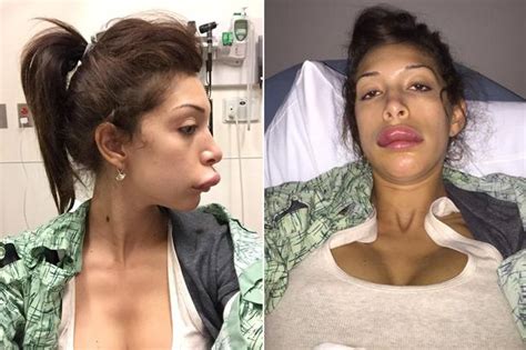 teen mom s farrah abraham reveals botched lip surgery in shocking photos mirror online