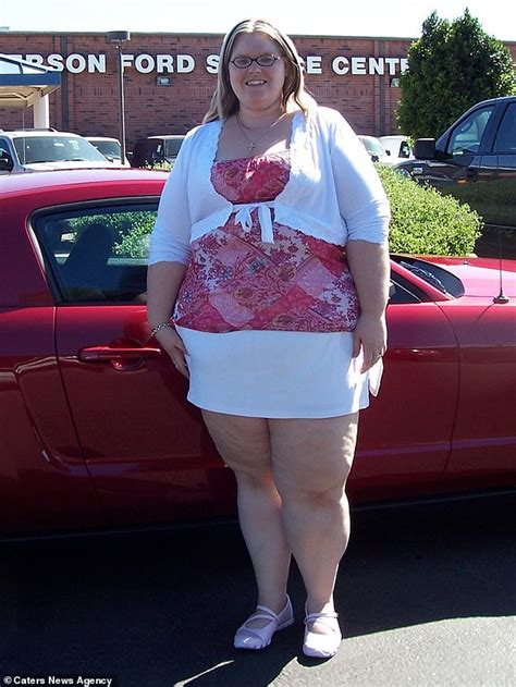 Woman Who Is Left With Sagging Skin After Losing 196lbs