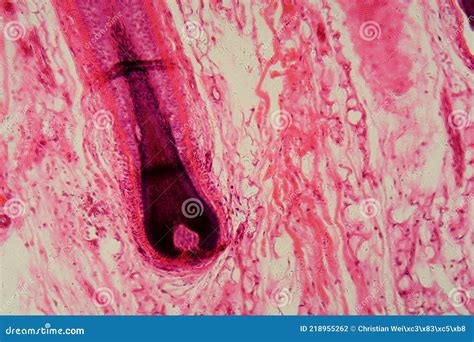 human hair follicle  skin   microscope stock photo image  medicine dermatology