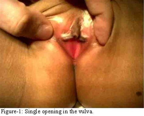 development of girls vagina image 4 fap