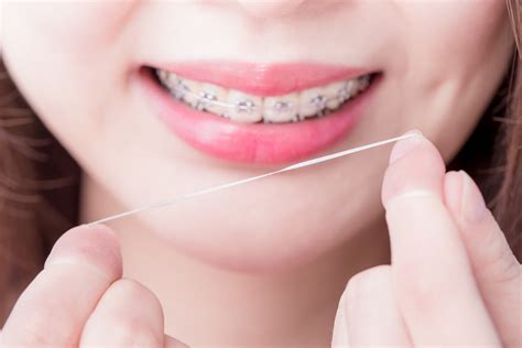 ways  clean  teeth    braces dedicated dental care