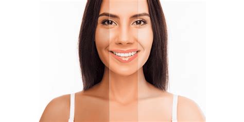 skin bleaching malaysia permanent effective solutions  skin types