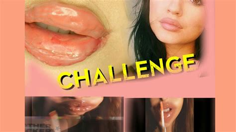 Kyliejenner Lips Challenge Youtube