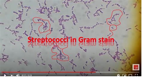 The Gallery For Streptococcus Agalactiae Gram Stain