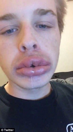 people who failed at the kylie jenner lip challenge