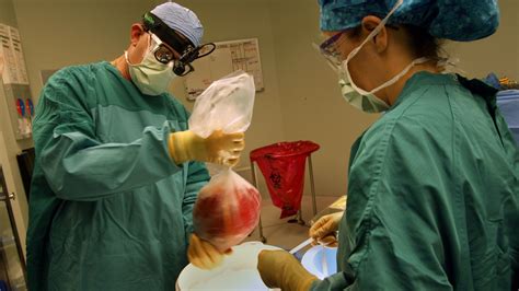 turf battle  organs  policy review rattles  national transplant system  san