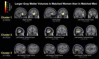 why sex matters brain size independent differences in gray matter