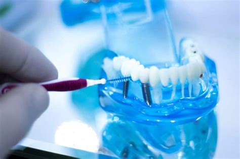 clean dental implants properly dental implant care