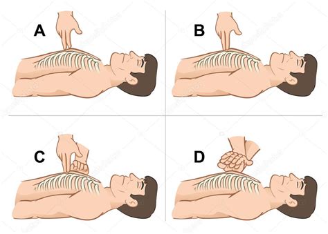 First Aid Resuscitation Cpr Massage Compression Of The Rib Cage
