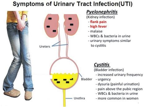 urinary tract infections continental hospitals blog