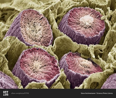 magnification view of sperm production under a color scanning electron